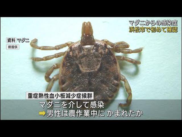 画像: マダニから感染… 浜松市で重症熱性血小板減少症候群の患者を確認 youtu.be