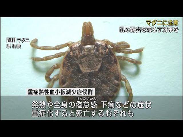 画像: マダニにかまれ感染か…60代女性が重症熱性血小板減少症候群を発病 重症化すると死亡する恐れも…県内3例目 静岡市 youtu.be
