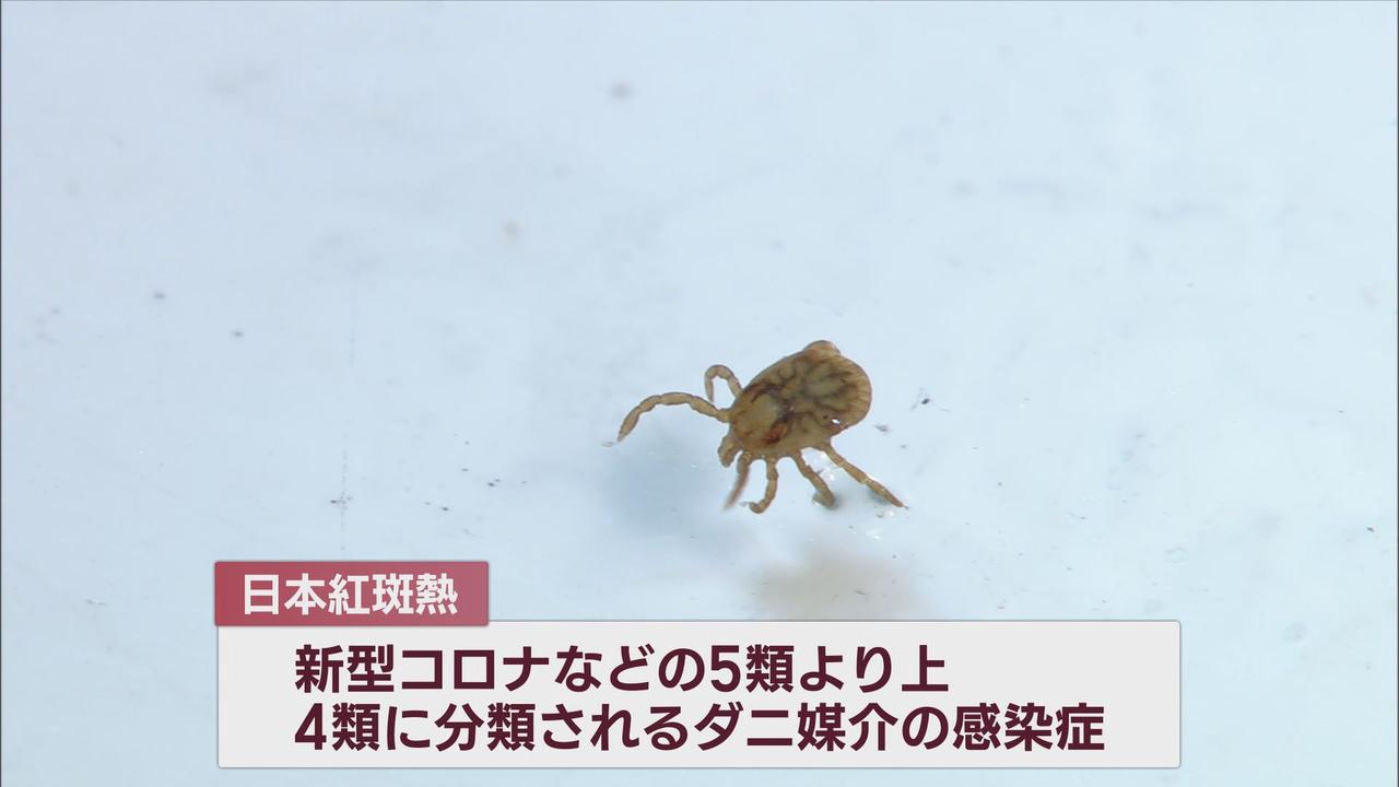 画像2: 30代男性マダニにかまれ「日本紅斑熱」感染…静岡県内で今年4例目 過去5年間では2人が死亡 活発化するマダニ…感染を防ぐには? かまれたらどう対応?